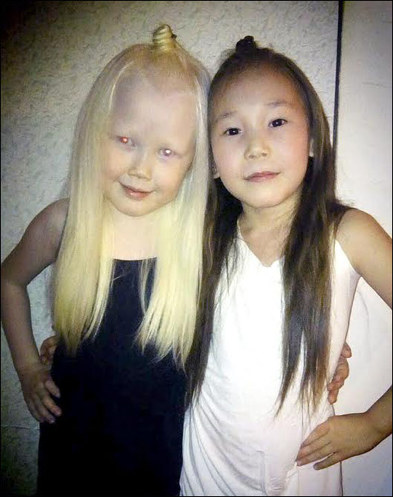 Albino Girl Known As Snow White Becomes As Internet Sensation In Siberia